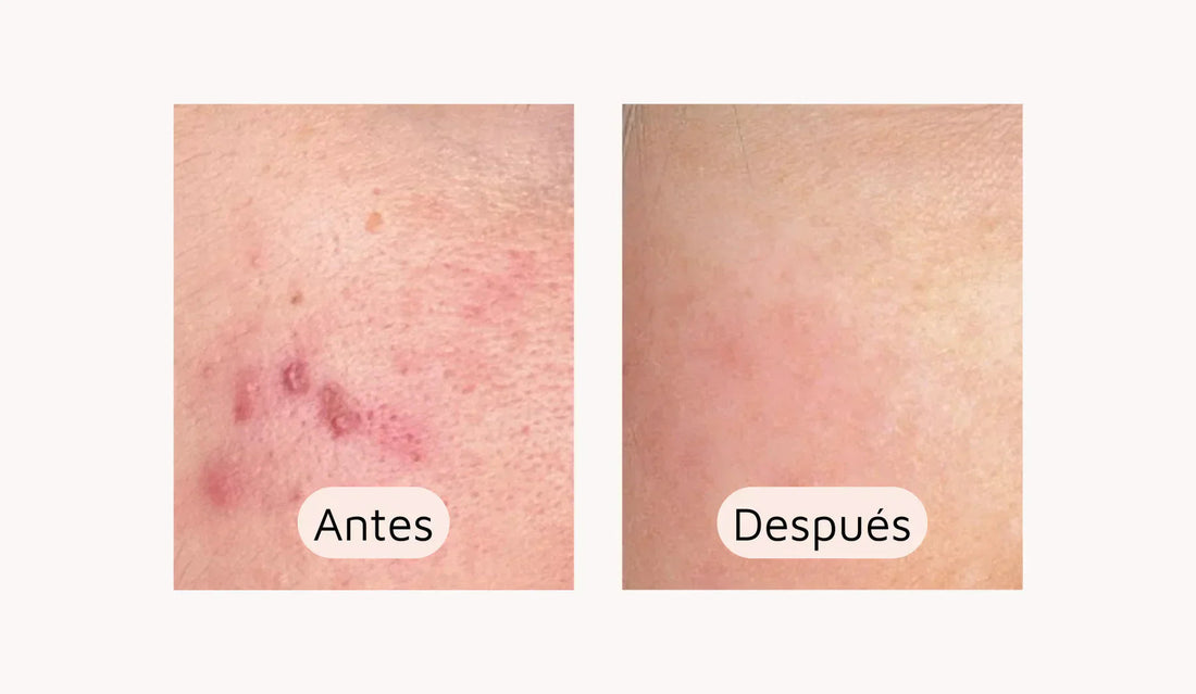 "Lo más sorprendente fue la rapidez con la que noté los cambios"